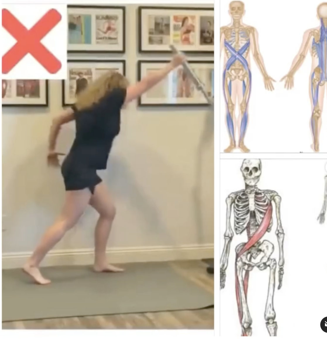 shoulder pain